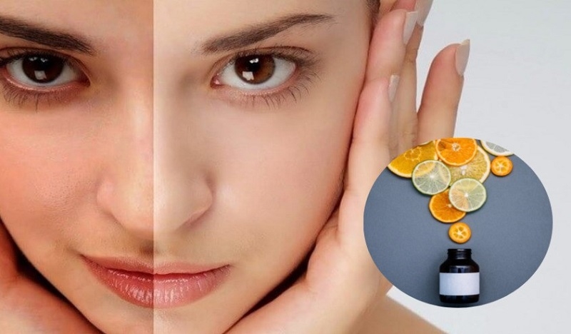 Bổ sung vitamin: Con đường tắt đến làn da đẹp? Những điều bạn cần biết