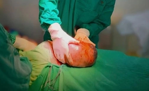 Em bé đẻ bọc điều: Hiếm gặp và mang nhiều ý nghĩa tốt đẹp