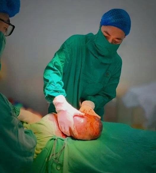 đẻ bọc điều, túi ối, sinh nở, em bé